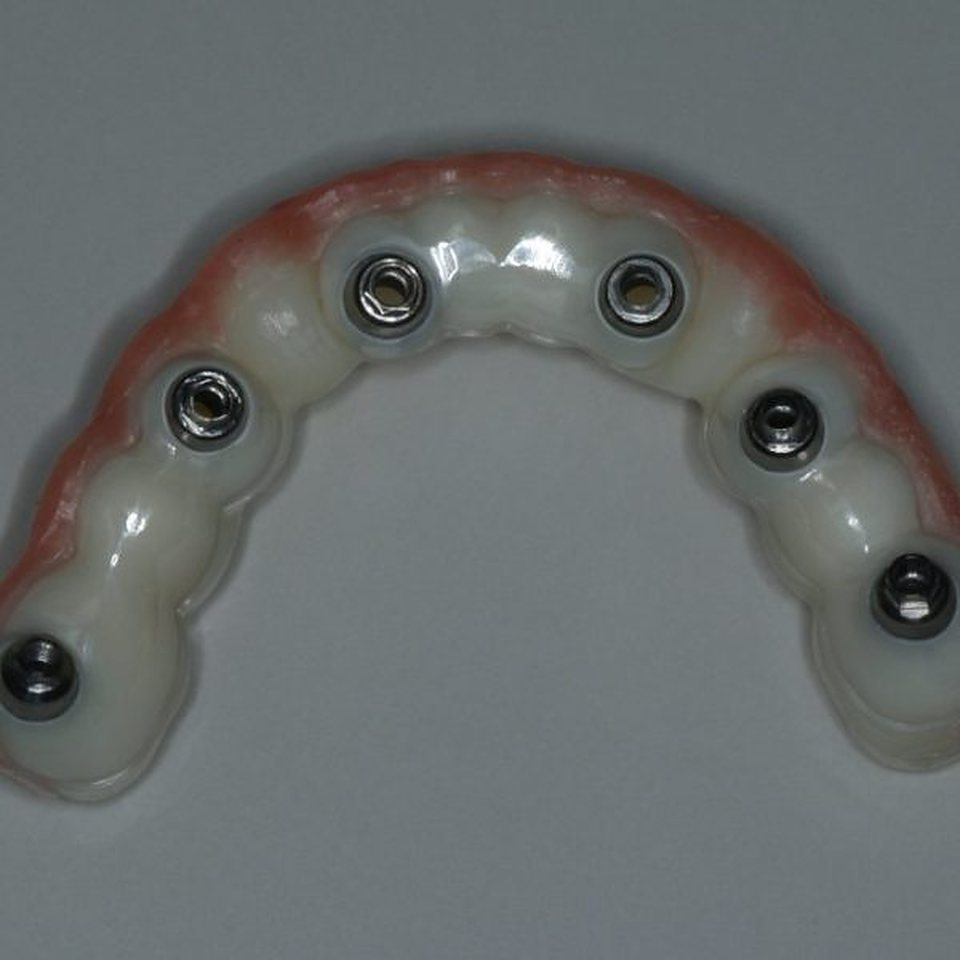 A Prosthotech full-arch restoration on the bench